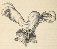 An illustration from The American journal of the medical sciences (1827)