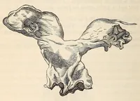 An illustration from The American journal of the medical sciences (1827)