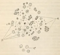 An illustration from The American journal of the medical sciences (1827)