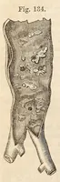 Picture 10 of 13 from The American journal of the medical sciences (1827), leaf 458