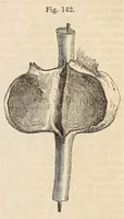 Picture 12 of 13 from The American journal of the medical sciences (1827), leaf 461