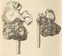 An illustration from The American journal of the medical sciences (1827)
