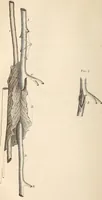 An illustration from The American journal of the medical sciences (1827)