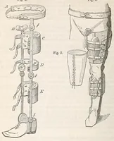An illustration from The American journal of the medical sciences (1827)
