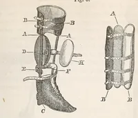 An illustration from The American journal of the medical sciences (1827)