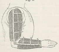 An illustration from The American journal of the medical sciences (1827)