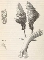 An illustration from The American journal of the medical sciences (1827)