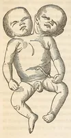 An illustration from The American journal of the medical sciences (1827)