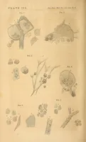 An illustration from The American journal of the medical sciences (1827)