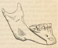 An illustration from The American journal of the medical sciences (1827)