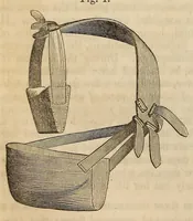 An illustration from The American journal of the medical sciences (1827)