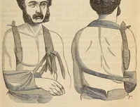 An illustration from The American journal of the medical sciences (1827)