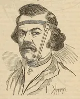 An illustration from The American journal of the medical sciences (1827)