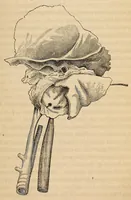 An illustration from The American journal of the medical sciences (1827)