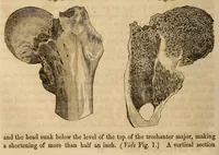 Picture 7 of 16 from The American journal of the medical sciences (1827), leaf 312
