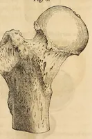 An illustration from The American journal of the medical sciences (1827)