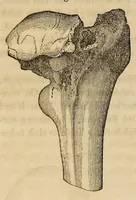 Picture 9 of 16 from The American journal of the medical sciences (1827), leaf 314