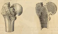 An illustration from The American journal of the medical sciences (1827)