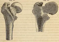An illustration from The American journal of the medical sciences (1827)