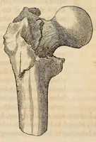 An illustration from The American journal of the medical sciences (1827)