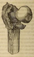 Picture 16 of 16 from The American journal of the medical sciences (1827), leaf 320