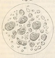 Picture 4 of 7 from The American journal of the medical sciences (1827), leaf 122