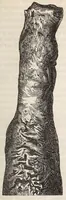An illustration from The American journal of the medical sciences (1827)