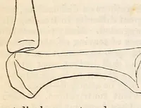 An illustration from The American journal of the medical sciences (1827)