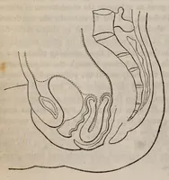 An illustration from The American journal of the medical sciences (1827)