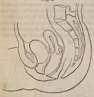 An illustration from The American journal of the medical sciences (1827)