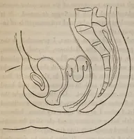 An illustration from The American journal of the medical sciences (1827)