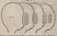 Picture 4 of 5 from The American journal of the medical sciences (1827), leaf 58
