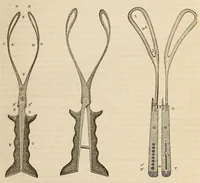 An illustration from The American journal of the medical sciences (1827)