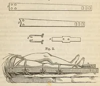 An illustration from The American journal of the medical sciences (1827)