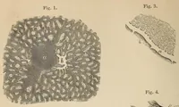 An illustration from The American journal of the medical sciences (1827)
