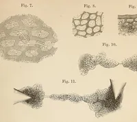 An illustration from The American journal of the medical sciences (1827)