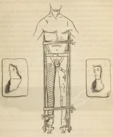 An illustration from The American journal of the medical sciences (1827)