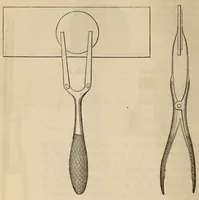 An illustration from The American journal of the medical sciences (1827)