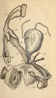 An illustration from The American journal of the medical sciences (1827)