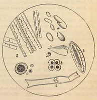 An illustration from The American journal of the medical sciences (1827)