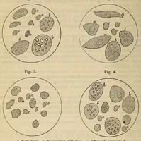 An illustration from The American journal of the medical sciences (1827)