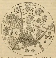 An illustration from The American journal of the medical sciences (1827)