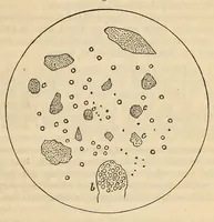 An illustration from The American journal of the medical sciences (1827)