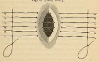 An illustration from The American journal of the medical sciences (1827)