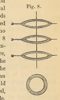 An illustration from The American journal of the medical sciences (1827)