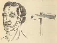 An illustration from The American journal of the medical sciences (1827)