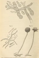 Picture 6 of 6 from The American journal of the medical sciences (1827), leaf 424