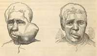 An illustration from The American journal of the medical sciences (1827)