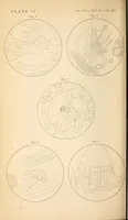 Picture 5 of 7 from The American journal of the medical sciences (1827), leaf 306