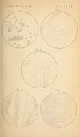 Picture 7 of 7 from The American journal of the medical sciences (1827), leaf 309